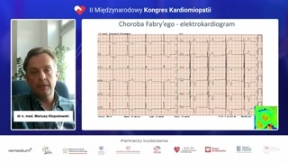 Charakterystyczne zmiany w EKG i Holterze