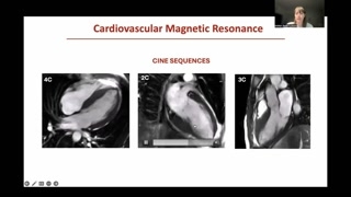 Cardiovascular Magnetic Resonance (CMR) Cine Findings
