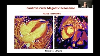 Summary of CMR Findings and Differential Diagnosis