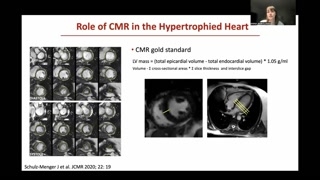 The Value of CMR in Hypertrophic Heart Assessment