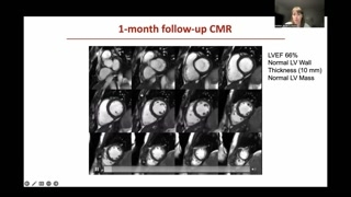 Post-Treatment CMR and ECG Normalization