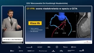 Indywidualizacja terapii przeciwdławicowej: diament leczenia