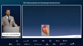 Diagnostyka mikrokrążenia i leczenie w ANOCA/INOCA
