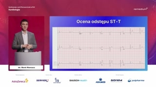 Ocena odstępu ST-T