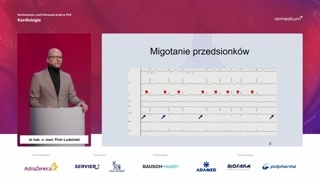 Diagnostyka arytmii: przykłady, wywiad i narzędzia