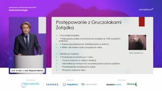 Rodzaje polipów żołądka i postępowanie