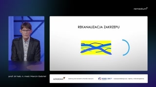 Dynamika powstawania i rekanalizacji zakrzepu