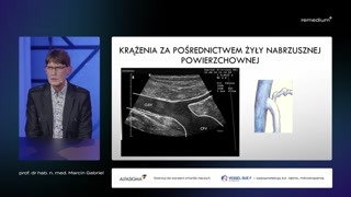 Przejście procesów ze układu powierzchownego do głębokiego