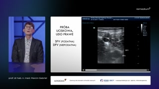Wykorzystanie głowicy i ocena żył biodrowych