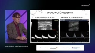 Analiza spektralna i przepłydy nisko oraz wysokooporowe