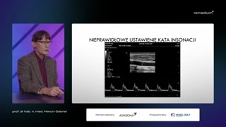 Ustawienia bramki Dopplera i znaczenie krótkiej kreski