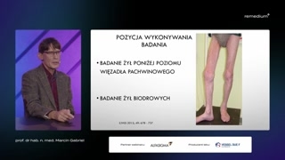 Wstęp do badania układu żylnego i przygotowanie pacjenta