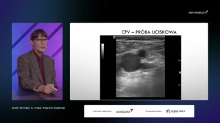 Próba uciskowa, kryteria refluksu i normy czasowe