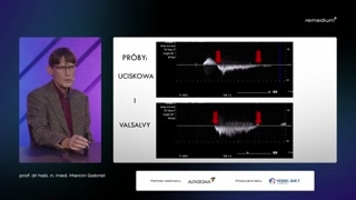 Sesja pytań i odpowiedzi oraz podsumowanie i zakończenie