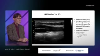 Współzależność żył i tętnic oraz przykłady kliniczne