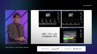 Ocena stopnia zwężenia: planimetria kontra hemodynamika