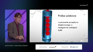 Badanie tętnic kończyn dolnych i kwalifikacja terapeutyczna