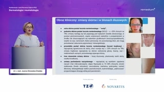 Trudności diagnostyczne i naturalny przebieg choroby