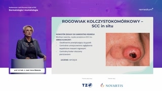 Rogowacenie słoneczne, rogowiak i rak kolczystokomórkowy