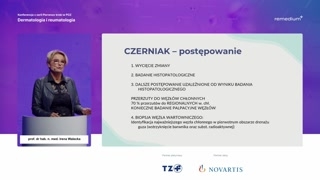 Chłoniaki skóry, zespół Sezary'ego i objawy paraneoplastyczne