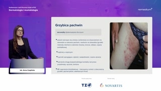 Grzybica pachwin i skóry gładkiej
