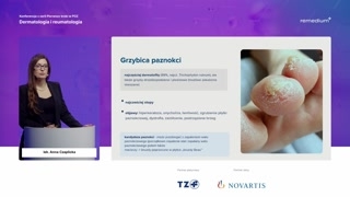 Grzybica paznokci: cechy i diagnostyka