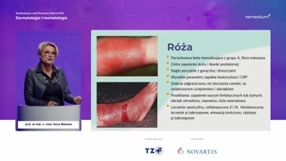 Róża i półpasiec — obraz kliniczny i leczenie