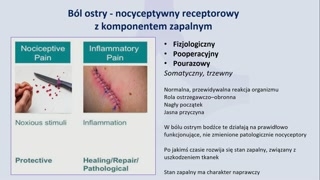 Klasyfikacja bólów i mechanizmy powstawania