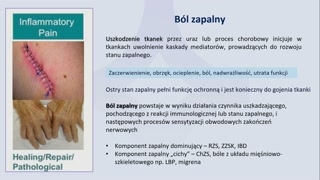Ból ostry kontra ból przewlekły