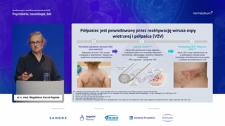 NLPZ-y: wybór leku i mechanizmy działania