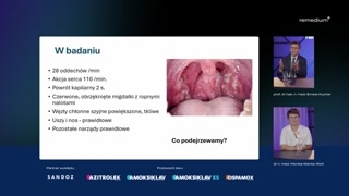 Angina paciorkowcowa: rozpoznanie, leczenie i dobór dawki