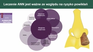 Alergia, diagnostyka i leczenie alergicznego nieżytu nosa