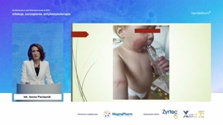 Panele alergenne dostępne w POZ