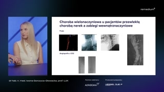 Perspektywa chirurgiczna i techniki minimalnie inwazyjne