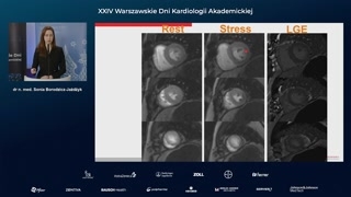 Przypadek kliniczny 2, badanie z dobutaminą i ocena żywotności