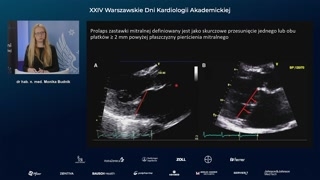 Prolaps mitralny, dysjunkcja pierścienia mitralnego (MAD) i znaczenie kliniczne