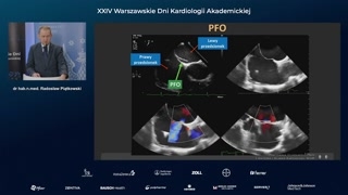 Mechanizmy PFO i zatorowości paradoksalnej