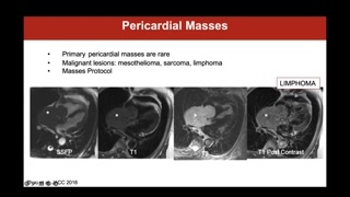 Constrictive pericarditis, pericardial masses, and reporting