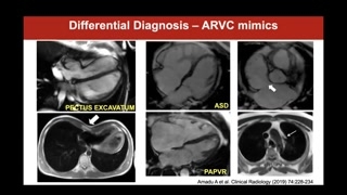Reporting, PADUA criteria, and practical recommendations