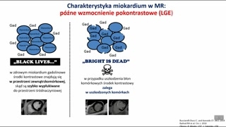 Późne wzmocnienie pokontrastowe — zasady i interpretacja