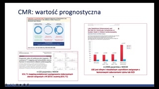 Mapowanie T1 i T2 oraz znaczenie prognostyczne LGE
