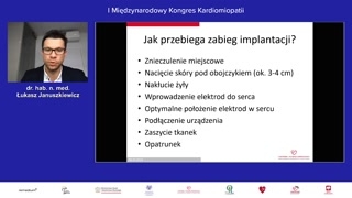 Implantacja układów i powikłania