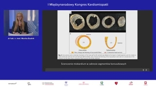 Objawy podkliniczne, wydolność i zmiany metaboliczne