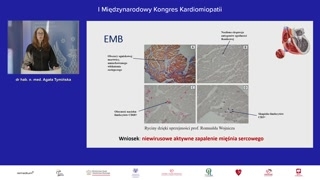 Leczenie, obserwacja i znaczenie biopsji