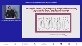 Techniki miektomii i ochrona układu przewodzącego