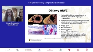 Epidemiologia, objawy kliniczne i kryteria diagnostyczne