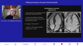 Rezonans magnetyczny: późne wzmocnienie i mapowanie T1