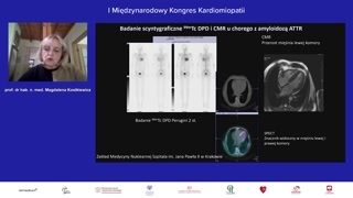Algorytm diagnostyczny i wskazania do badania izotopowego