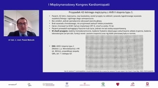 Wskazania do implantacji ICD i znaczenie genotypu