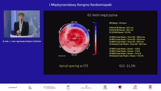 Rozróżnianie amyloidozy i kardiomiopatii przerostowej